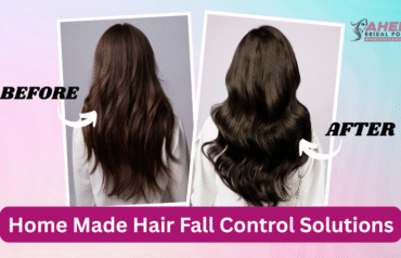 Hair Fall Control Solutions